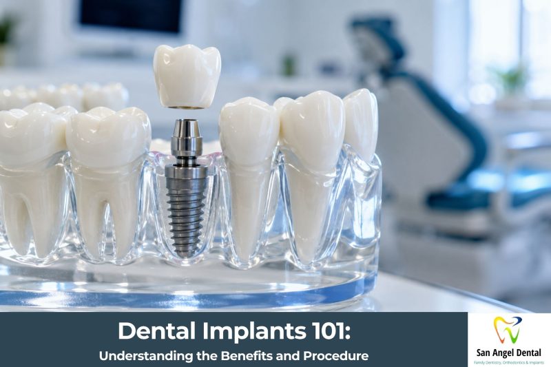 Dental Implants 101: Understanding the Benefits and Procedure